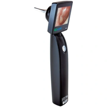 Video otoskops MD scope video otoscope DELUXE PACK
