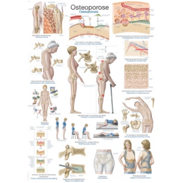 Uzskates materiāls - Osteoporoze Erler-Zimmer